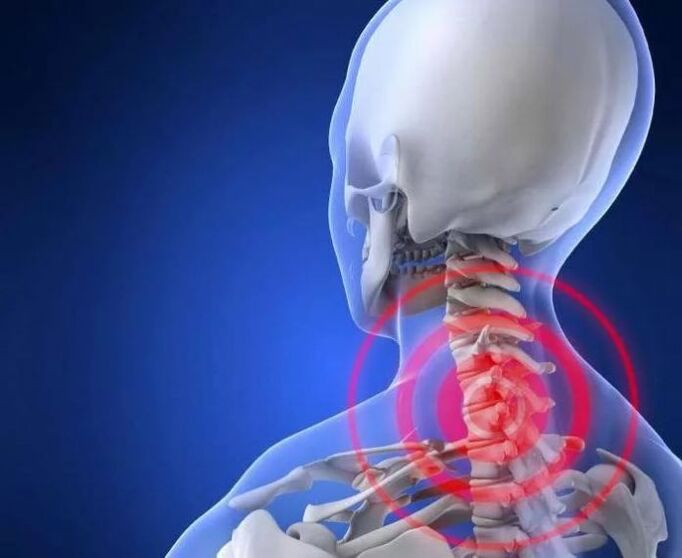 ¿Qué es la enfermedad osteocondral