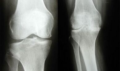 Método de diagnóstico de rodilla