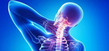 Causas de hueso cervical y condropatía