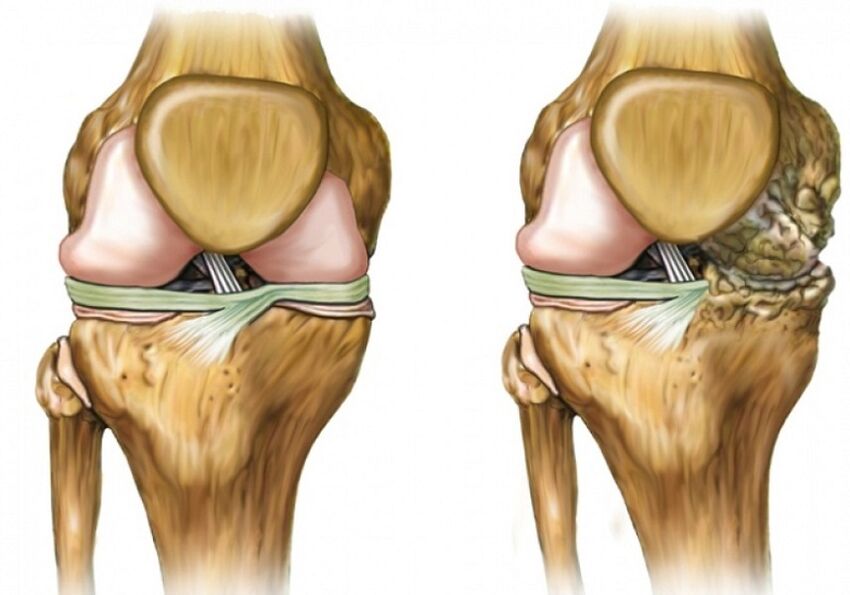 Articulación de la rodilla