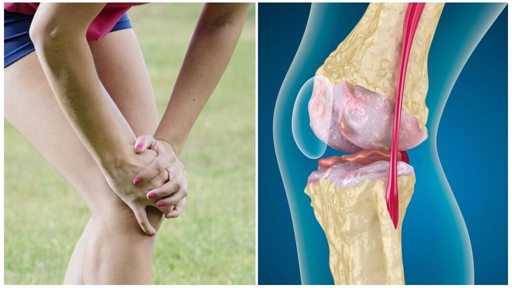 Síntoma articular