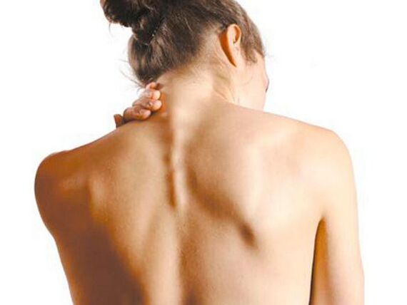 Niña que sufre de osteocondrosis cervical