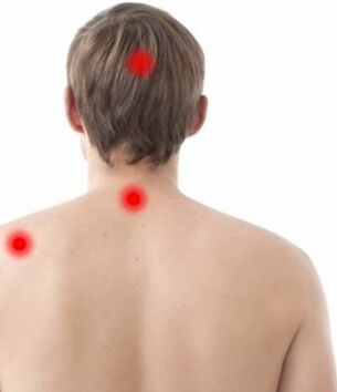 Área de dolor de osteocondrosis cervical