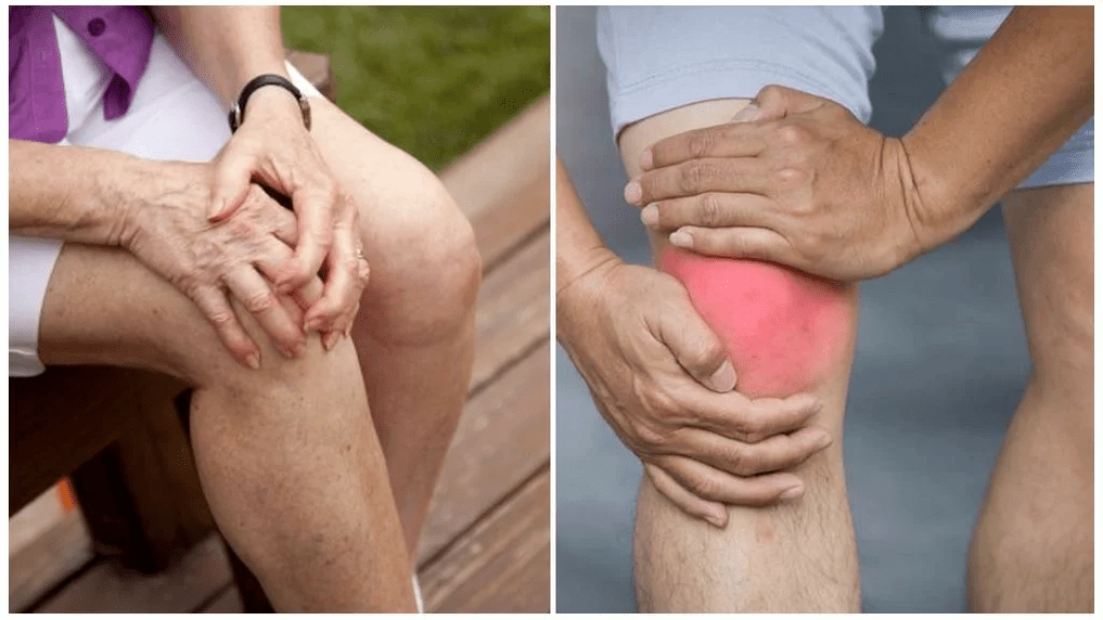 tratamiento articular