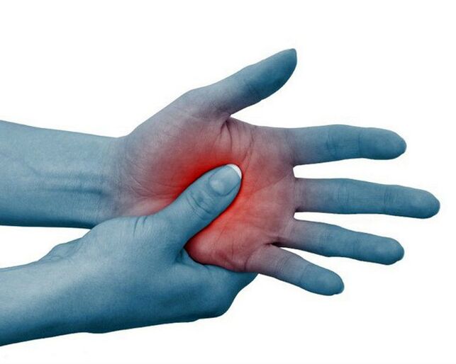 El dolor intenso en las articulaciones de los dedos es un síntoma clásico de la artritis reumatoide y disminuye con el ejercicio.